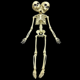 Twin Headed Skeleton